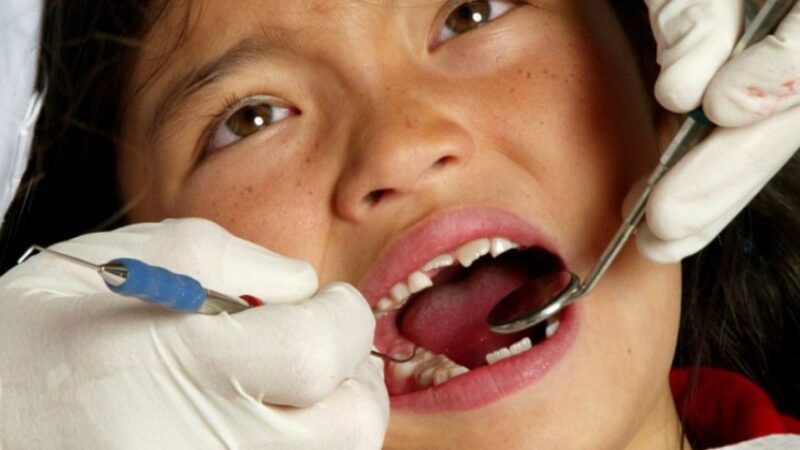 उपत्यकामा ७३ प्रतिशत बालबालिकामा दाँँत किराले खाने समस्या