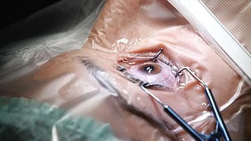 आँखा उपचार केन्द्र निर्माणका लागि आर्थिक सहयोग सङ्कलन