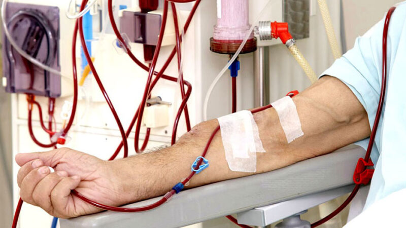 जिपी कोइराला उपचार केन्द्रमा डायलासिस क्षमता विस्तार