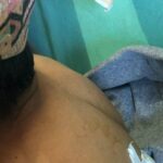 रसुवामा भालुको आक्रमणबाट दुई जना घाइते