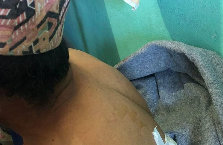 रसुवामा भालुको आक्रमणबाट दुई जना घाइते