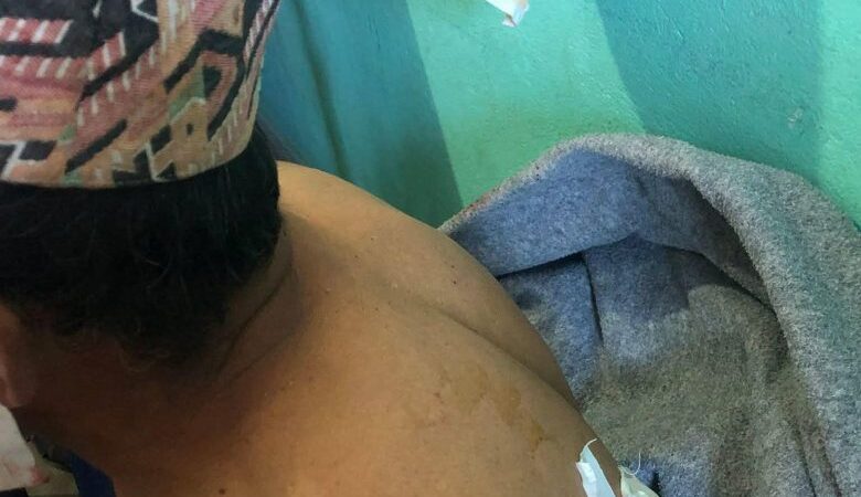 रसुवामा भालुको आक्रमणबाट दुई जना घाइते