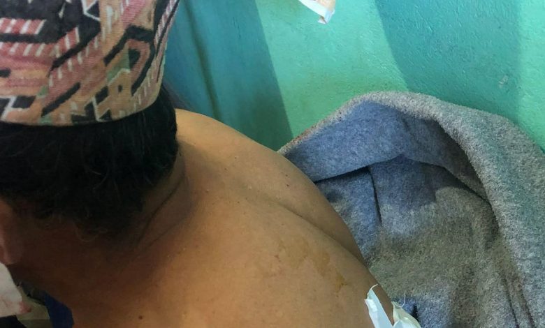 रसुवामा भालुको आक्रमणबाट दुई जना घाइते