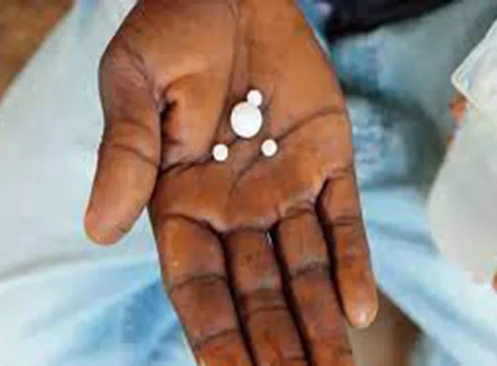 सर्लाहीमा चार लाखभन्दा बढीलाई हात्तीपाइलेविरुद्धको औषधि खुवाइने