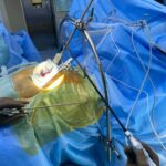 प्रा.डा. भट्टराईको अगुवाईमा नेपालमा पहिलोपटक एमआईसीएस प्रविधिबाट जन्मजात मुटुमा प्वाल भएको विरामीको ओपन हार्ट सर्जरी सम्पन्न प्रा.डा. भट्टराईको अगुवाईमा नेपालमा पहिलोपटक एमआईसीएस प्रविधिबाट जन्मजात मुटुमा प्वाल भएको विरामीको ओपन हार्ट सर्जरी सम्पन्न